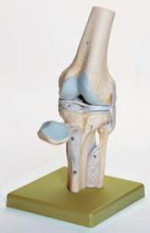 膝関節模型